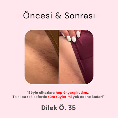 The Trimmie 2.0 By Ezme ( 2 si 1 arada Tıraş Makinesi )