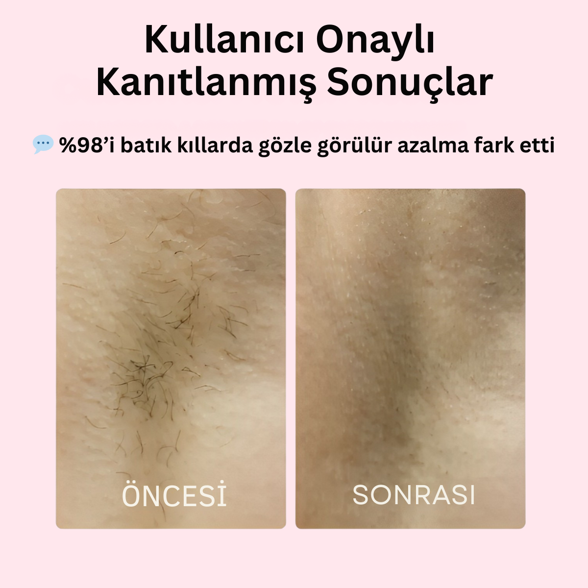 The Trimmie 2.0 By Ezme ( 2 si 1 arada Tıraş Makinesi )